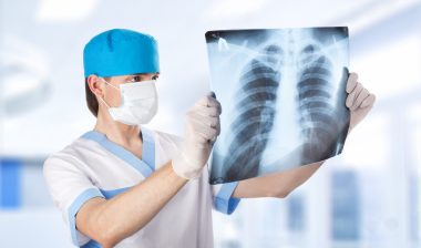 IVC filter complications Bard Meridian chest x-ray