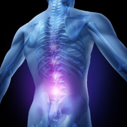 Zimmer Biomet spinal fusion stimulator recall lumbar spine