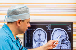 Dilantin cerebellar atrophy brain MRI doctor