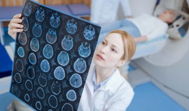 Dilantin cerebellar atrophy brain MRI