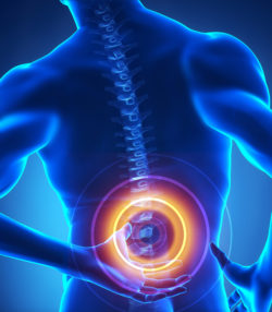 Zimmer Biomet spinal fusion stimulator recall
