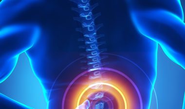 Zimmer Biomet spinal fusion stimulator recall