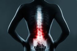 spinal fusion stimulator recall
