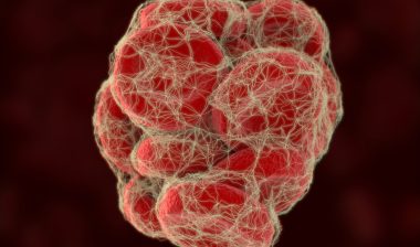 IVC-filter-risks