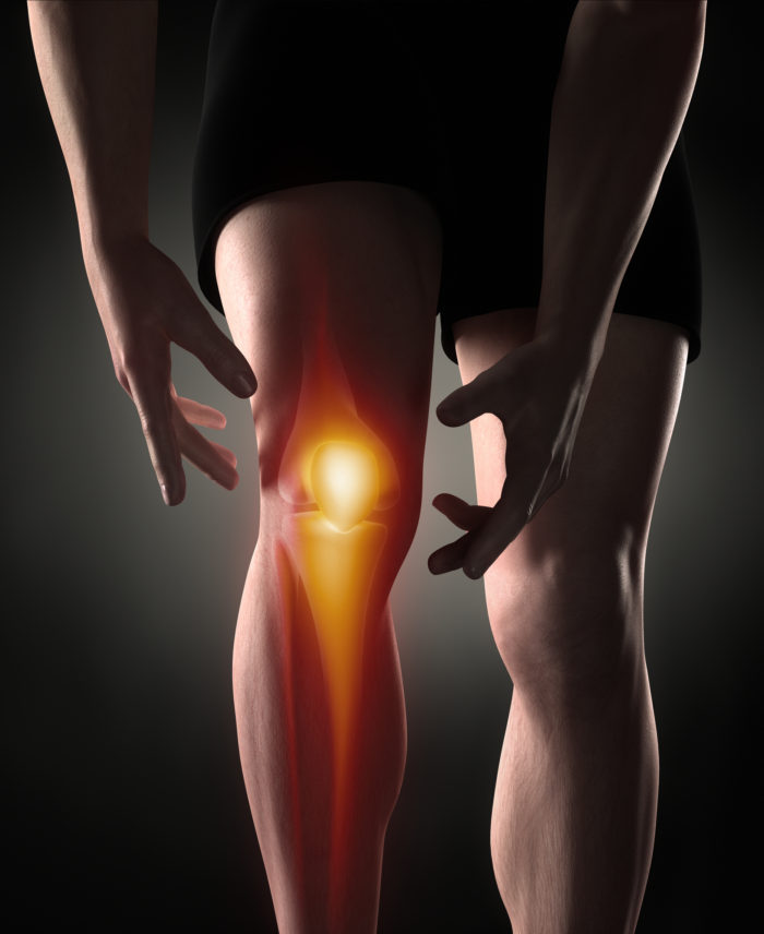 knee replacement, knee pain