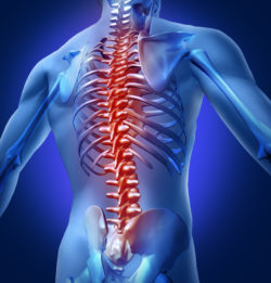 Human backache and back pain with an upper torso body skeleton showing the spine and vertebral column in red highlight as a medical health care concept for spinal surgery and therapy.