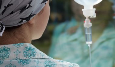 Taxotere permanent hair loss alopecia chemotherapy