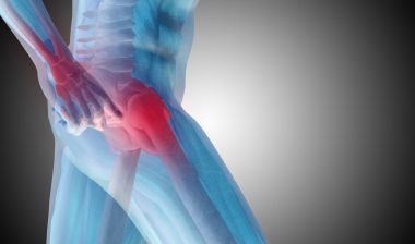Stryker-V40-femoral-head-recall