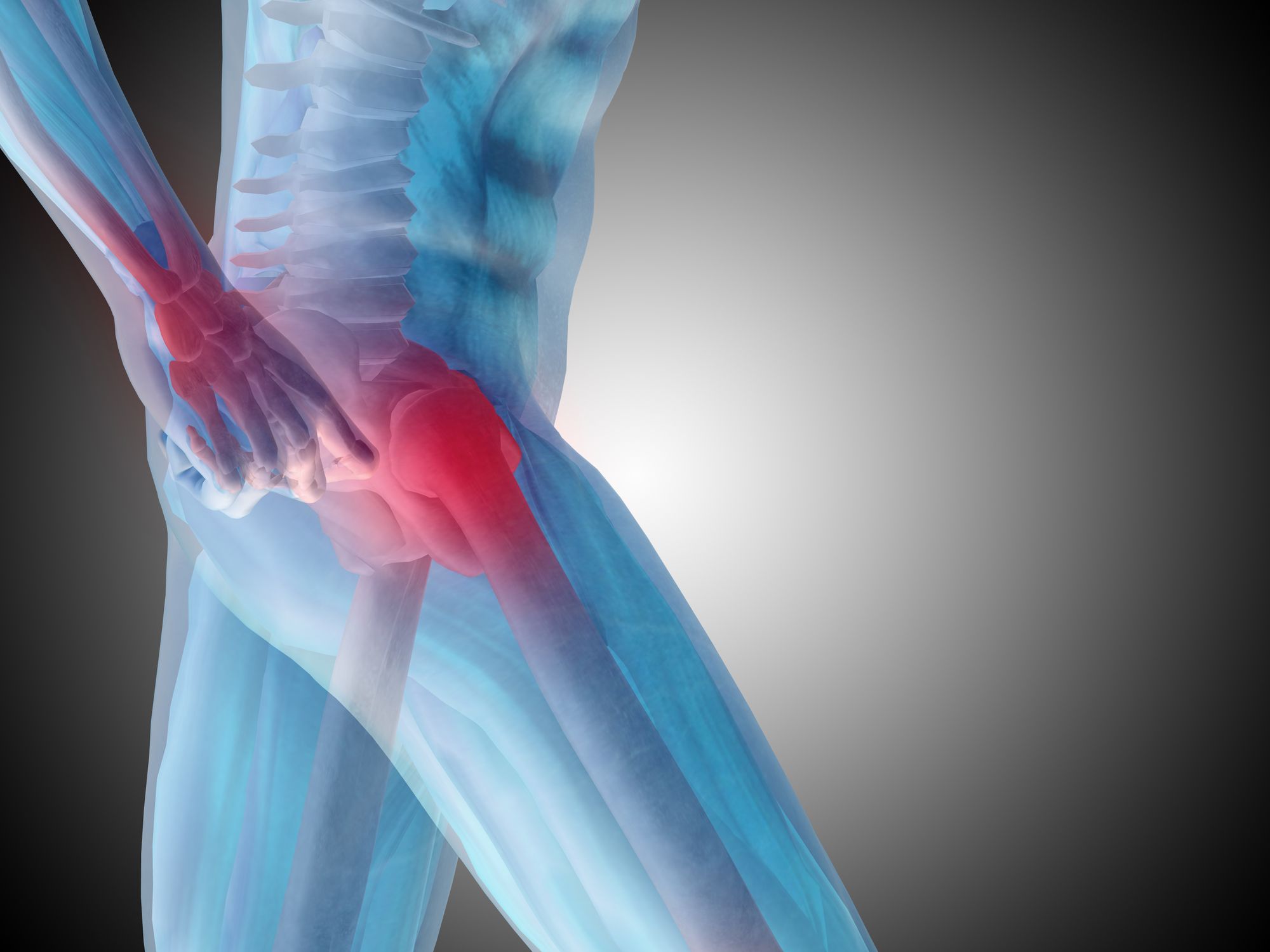 Stryker-V40-femoral-head-recall