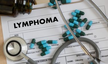 hodgkins lymphoma