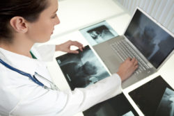 female medical doctor looking at x-rays of hip replacement