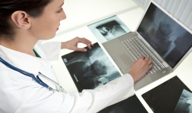 female medical doctor looking at x-rays of hip replacement