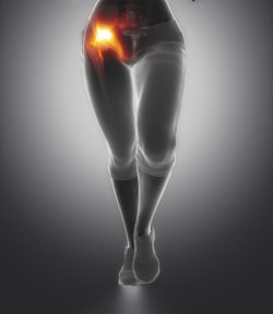 hip injury, hip replacement