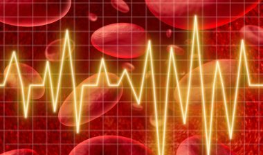 Xarelto bleeding