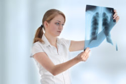 Female doctor examining a chest x-ray photo scan.