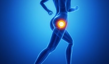 Stryker LFIT V40 femoral head recall hip implant