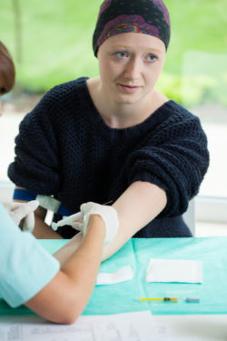 Taxotere permanent alopecia hair loss