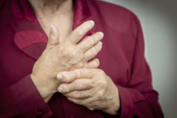 Actemra Rheumatoid arthritis hands