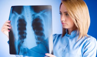 lung-cancer-and-asbestos-exposure