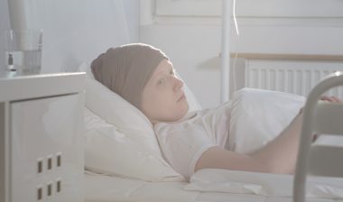 Taxotere cancer chemotherapy hair loss