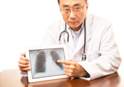 IVC filter chest X-ray