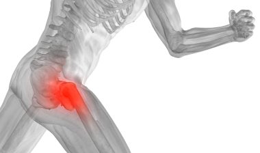 Stryker hip implant hip replacement