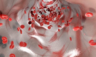 pradaxa bleeding