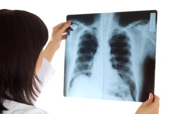 lung xray