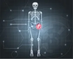 hip replacement