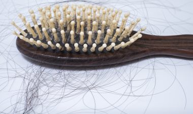 hair loss problem