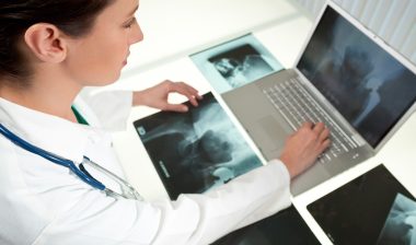 ASR metal on metal hip replacement have led to revision surgeries