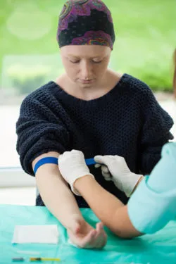 Taxotere chemotherapy hair loss alopecia cancer