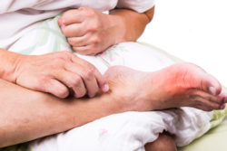 gout inflammation