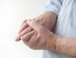 Uloric gout arthritis cardiac arrest