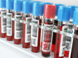 Blood sample positive and many others blood test tubes in a rack. 3d illustration