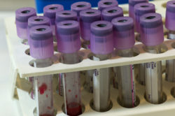 blood thinner
