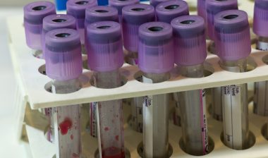 blood thinner