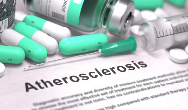 Tasigna atherosclerosis medical record