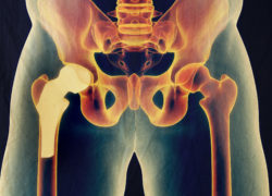 Depositphotos_129019572_l-2015