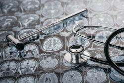 brain xrays with stethoscope