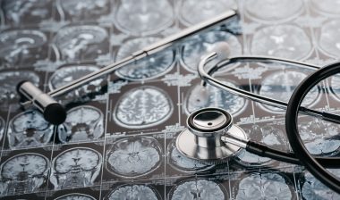 brain xrays with stethoscope