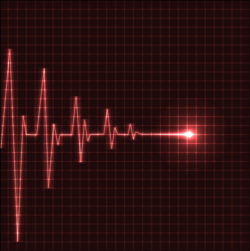 heart beats cardiogram