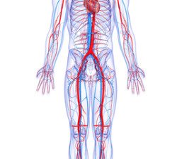 Growing Cook Medical MDL gets new Inferior Vena Cava Filter Lawsuit