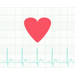 Uloric cardiac ischemia heart EKG