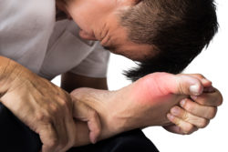 Uloric cardiovascular side effects gout man holding foot in pain