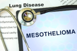 Couple Files Asbestos Mesothelioma Lawsuit Due to Cancer Diagnosis