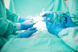 Closeup of four sets of hands of surgeons working on a patient with several instruments