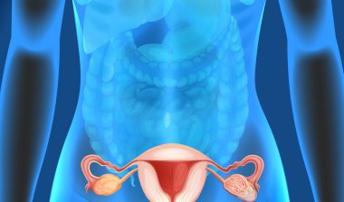 female genitals, ovarian cancer