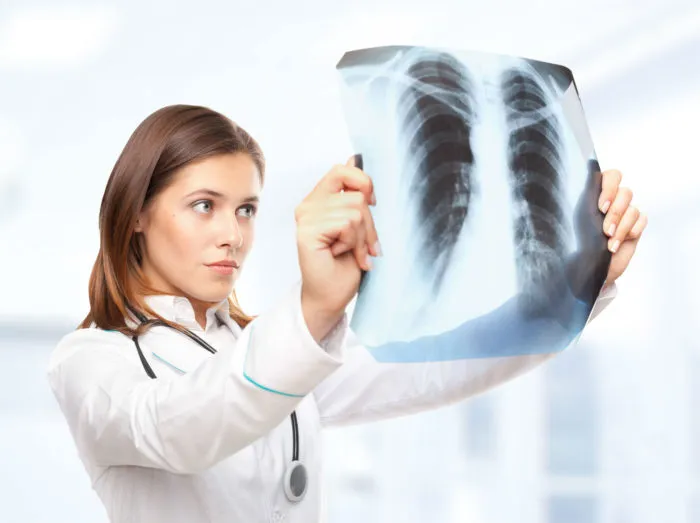 Inferior Vena Cava (IVC) Filter Side Effects Class Action Lawsuit Investigation