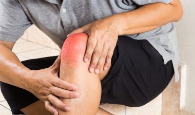 Uloric gout arthritis man with knee pain